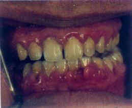 �ʴ�������