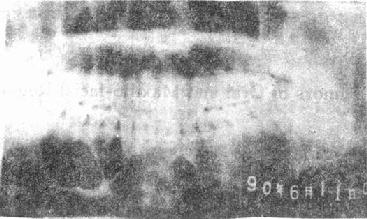 XƬʾ������ϸ��<a href=