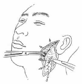 ���Ի�ŧ�������׵��п�����