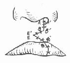 �����޸�����Ϻ�