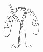 ����ճĤ��Ĥ��