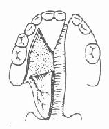 ����ճ��Ĥ��