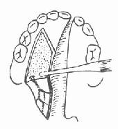 ��������Ĥ