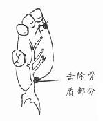 ���׺�Ե������ȥ��