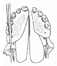 ˫����������