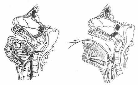 ���׹������������� �ô��߽���ǣ��