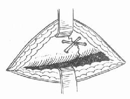 �Ǽ�����̶���