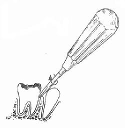 ��ͦ���÷���ʾ��ͼ