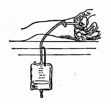 �������Ӧ��